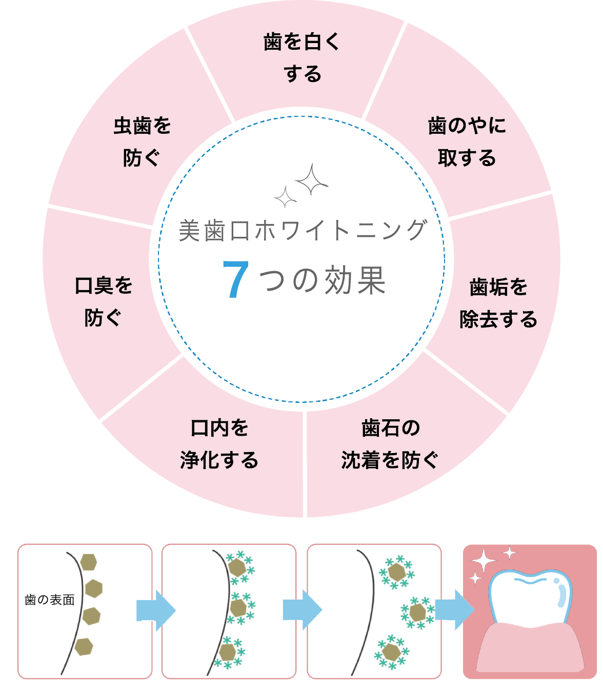 セルフホワイトニング専門店チェリーブロッサムの